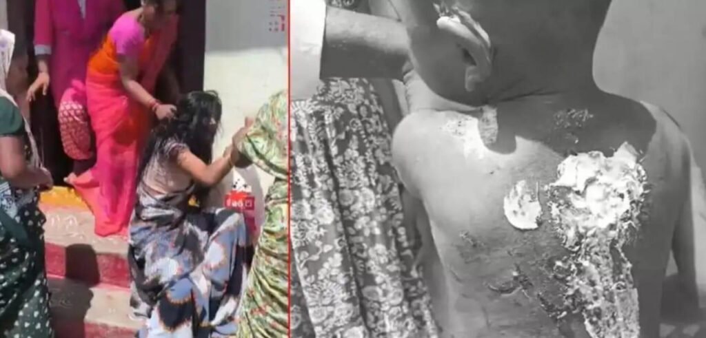 మాతృత్వానికే మచ్చ.. ప్రియుడితో కలిసి పిల్లలపై చిత్రహింసలు